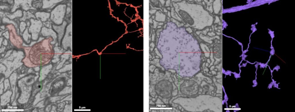 Bulges in neurites caused by a mitochondrion (left) vs. a synaptic bouton (right).